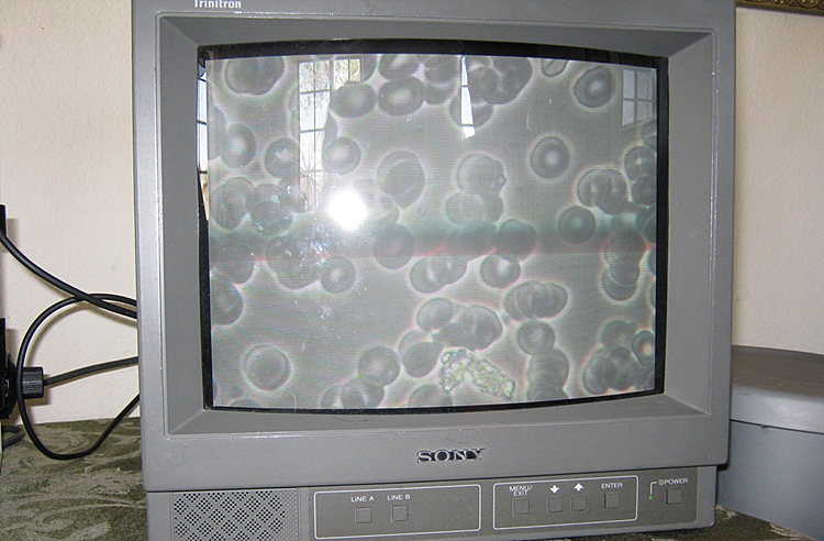 blood3